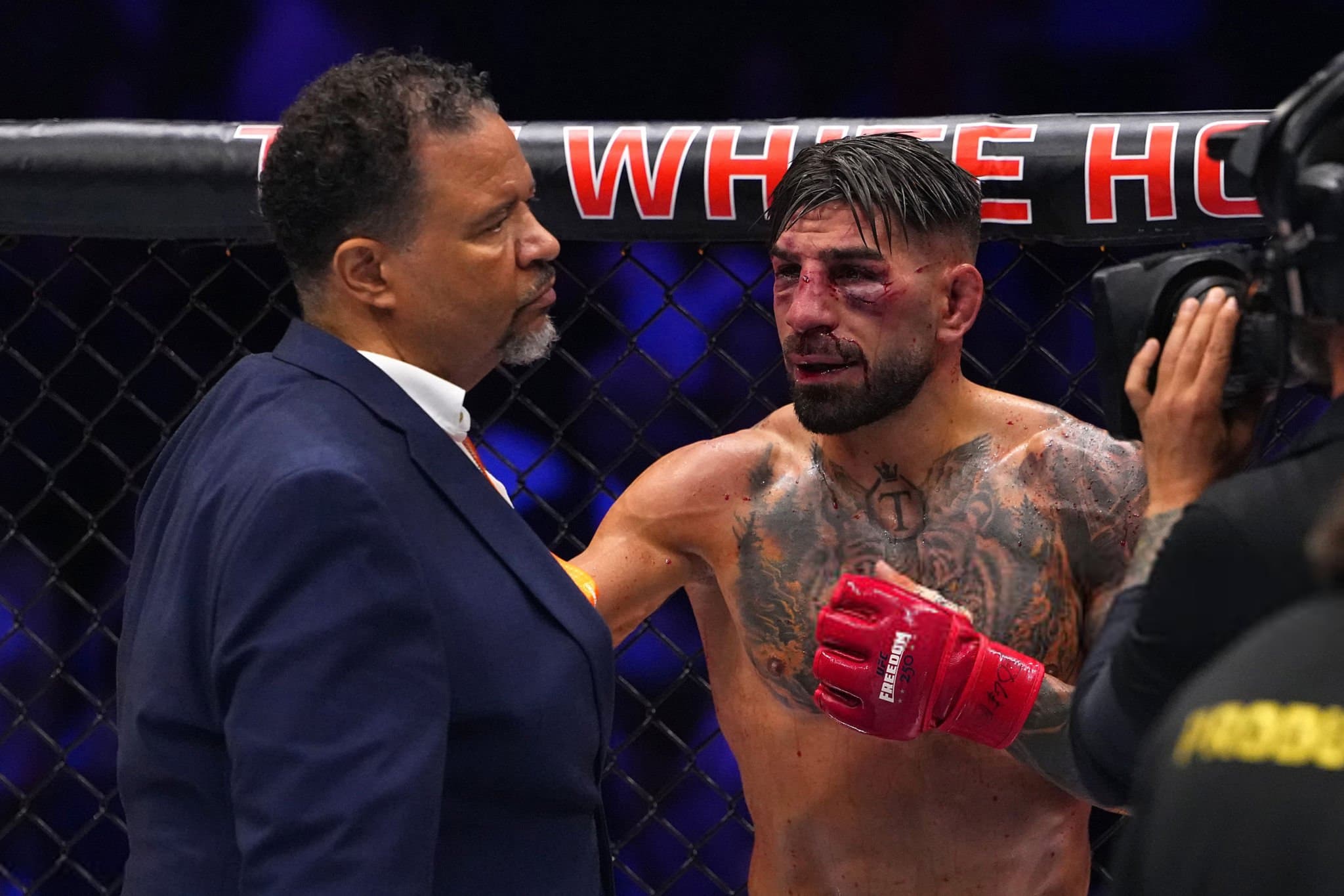 Боец UFC Илия Топурия получил перелом глазницы в жестком противостоянии с Гэтжи
